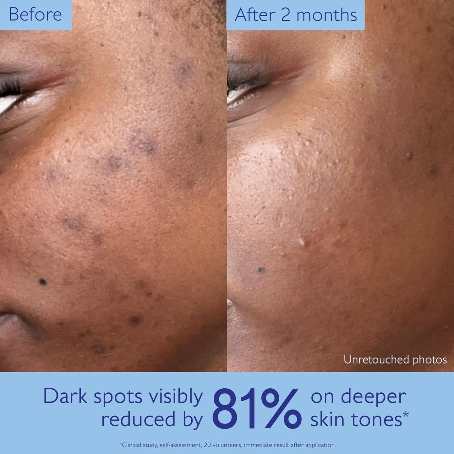 Caudalie Vinoperfect Dark Spot Serum with Viniferine 30ml