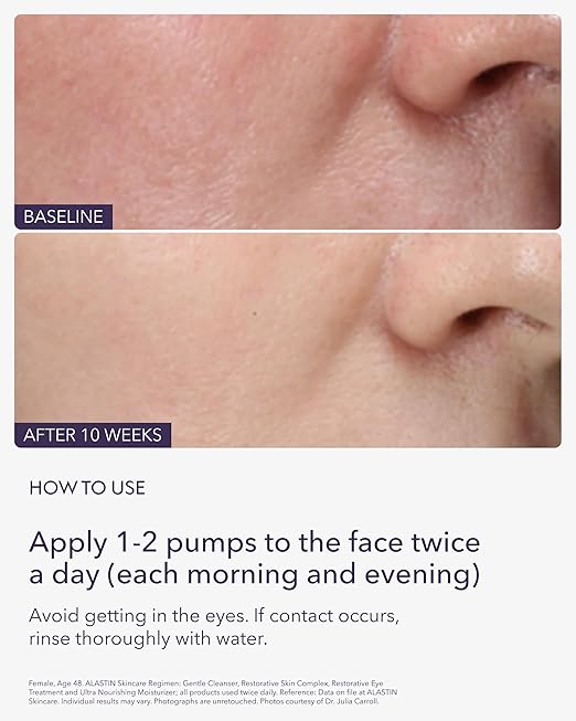 ALASTIN Restorative Skin Complex — Peptide + Niacinamide Serum (1 fl oz / 30 mL)