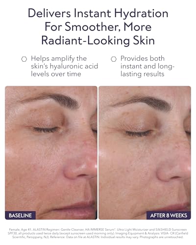 ALASTIN Skincare Hyaluronic Acid HA IMMERSE Moisturizing Face Serum (1 oz) | Restorative Serum Combats Dry, Dehydrated Skin | For Radiant, Glowing Skin