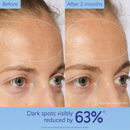 Caudalie Vinoperfect Dark Spot Serum with Viniferine 30ml