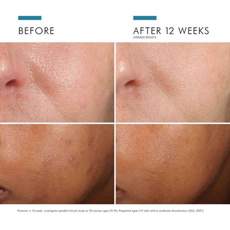 SkinCeuticals Phloretin CF Serum 30ml – Vitamin C & Ferulic Acid Antioxidant