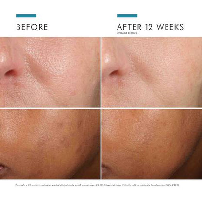 SkinCeuticals Phloretin CF Serum 30ml – Vitamin C & Ferulic Acid Antioxidant